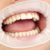 DentaMedix O-Style Latex Cheek Retractor 60/Box White